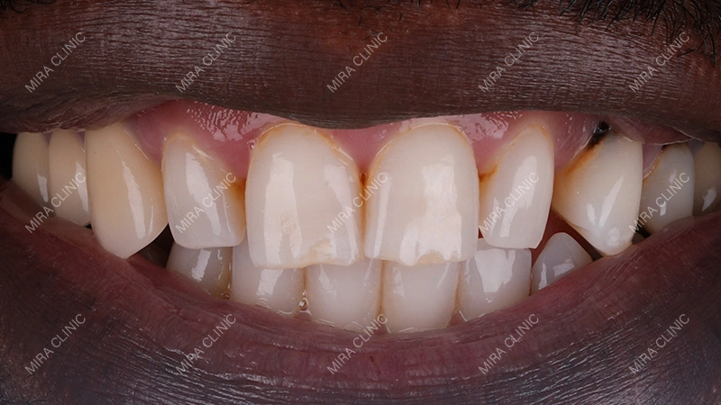 bad experience with a dentist in the past